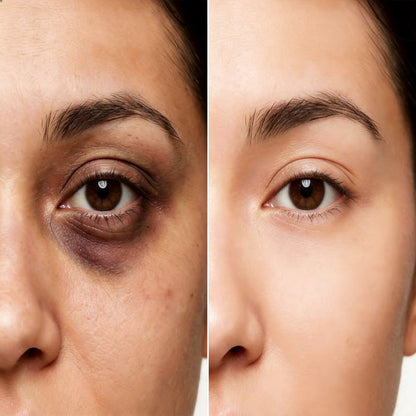 Calcium Dark Spot Eye Cream