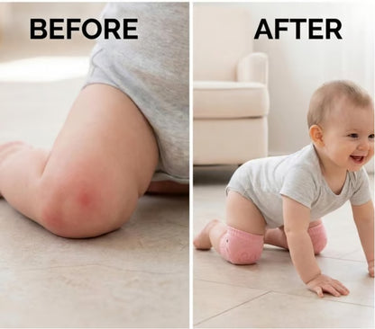 Baby 5-Pair Non-Slip Knee Pads, Thick Soft Contoured Fit for Crawling, Durable Fall Protection